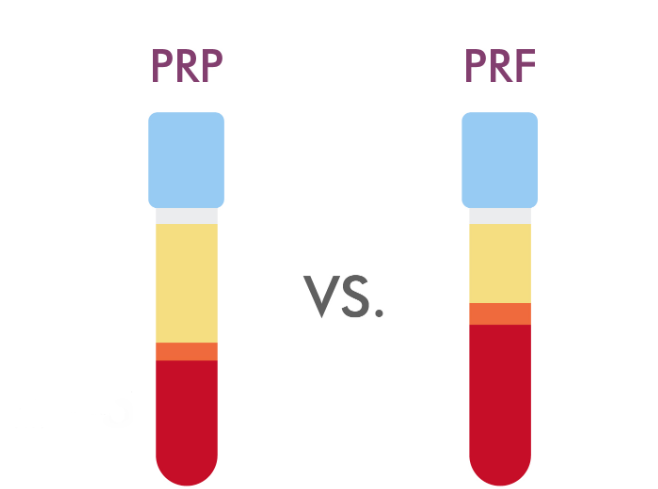 PRP and PRF | PRP KIT, PRP TUBE, Platelet Rich Plasma,Needle, Cannula